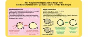 Illustration labeled "How myopia control spectacle lens design work", showing lenses treating childhood myopia. On the left there are two pictures of eyeballs, with the text "Single vision correction", "Peripheral light rays focus behind the retina. Encourages eye growth and increased myopia progression." The diagram of the eye furthest to the left shows light rays focusing behind, and significantly above, the eyeball at an angle. It is labeled "Peripheral light rays." The diagram of an eye next to it shows an elongated eyeball, shaped more like a football, with the caption "Eye grows longer and becomes more myopic". The right side of the diagram is labeled "Myopia control design", "Lenslets focus light in front of the retina. Slows progression of myopia." On the left are diagrams of the Essilor Stellest and Hoya MIYOSMART lenses, with their lenslets highlighted. There are two diagrams of eyeballs on this side as well, a round